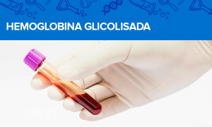 Hemoglobina Glicolisada
